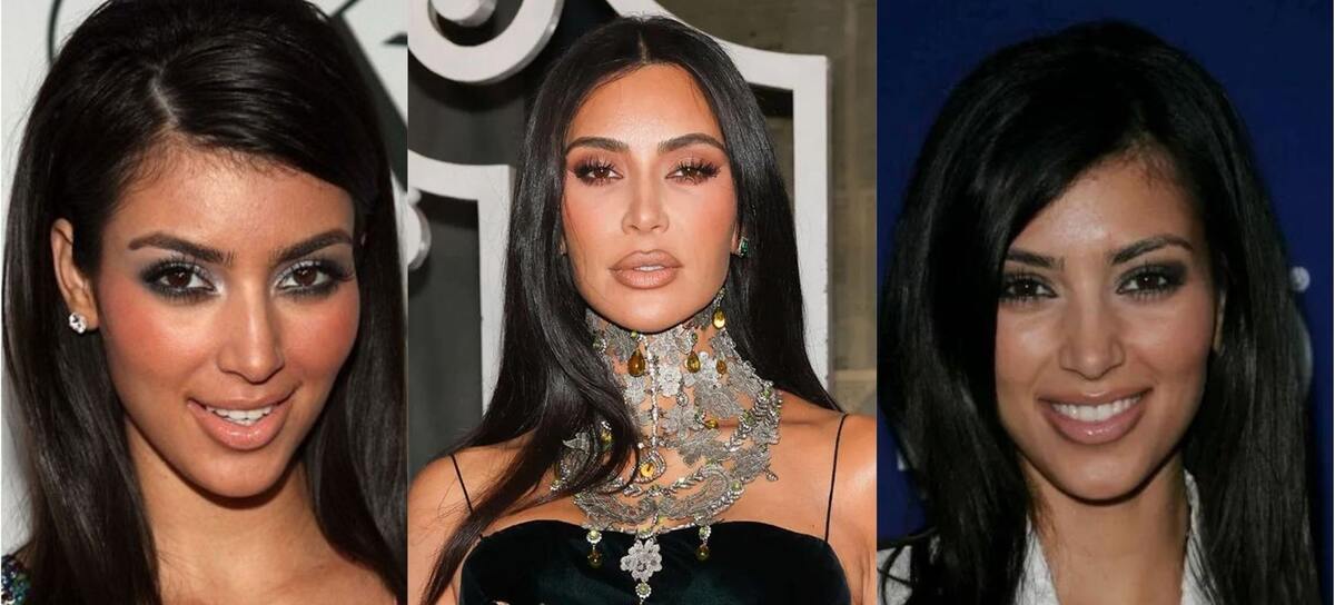 Kim Kardashian Before Plastic Surgery