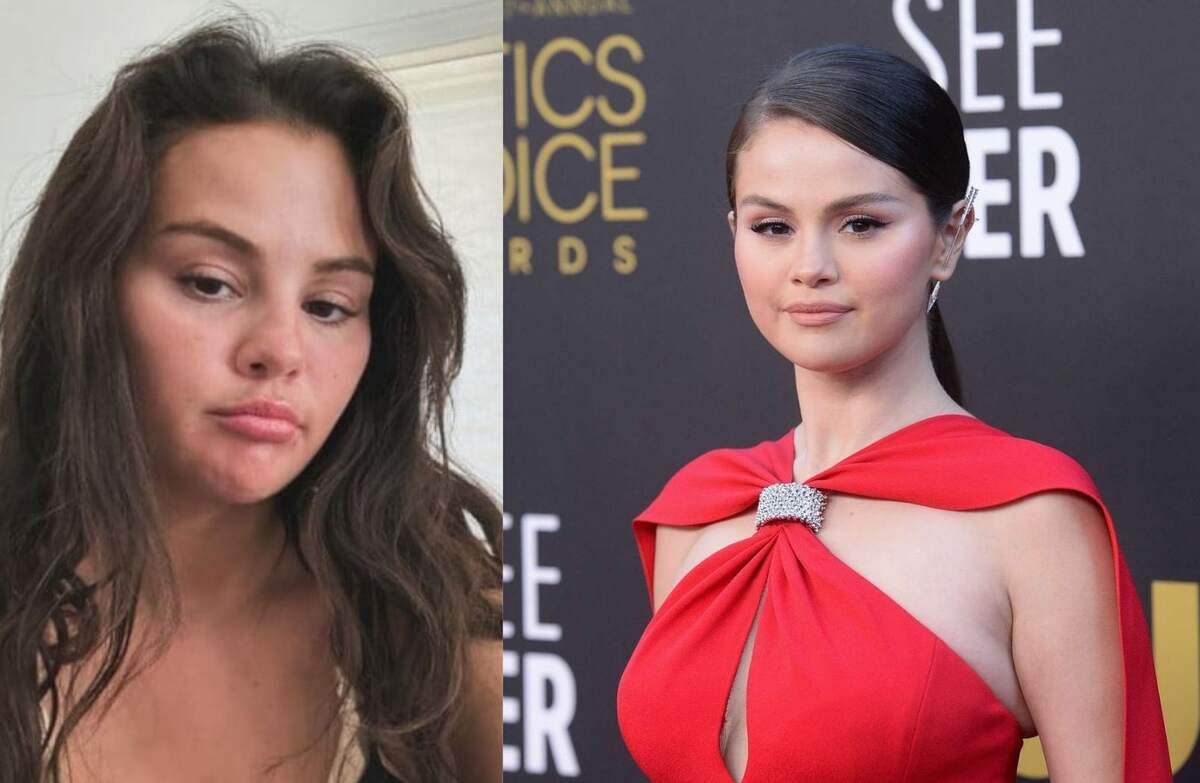 Selena Gomez Plastic Surgery