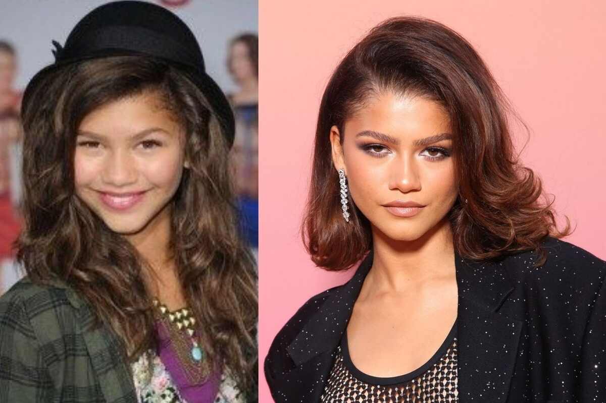 Zendaya Plastic Surgery